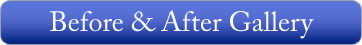 Before & After Gallery